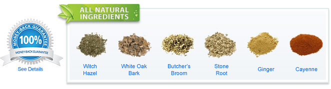 All natural ingredients: witch hazel, white oak bark, butcher's broom, stone root, ginger, cayenne